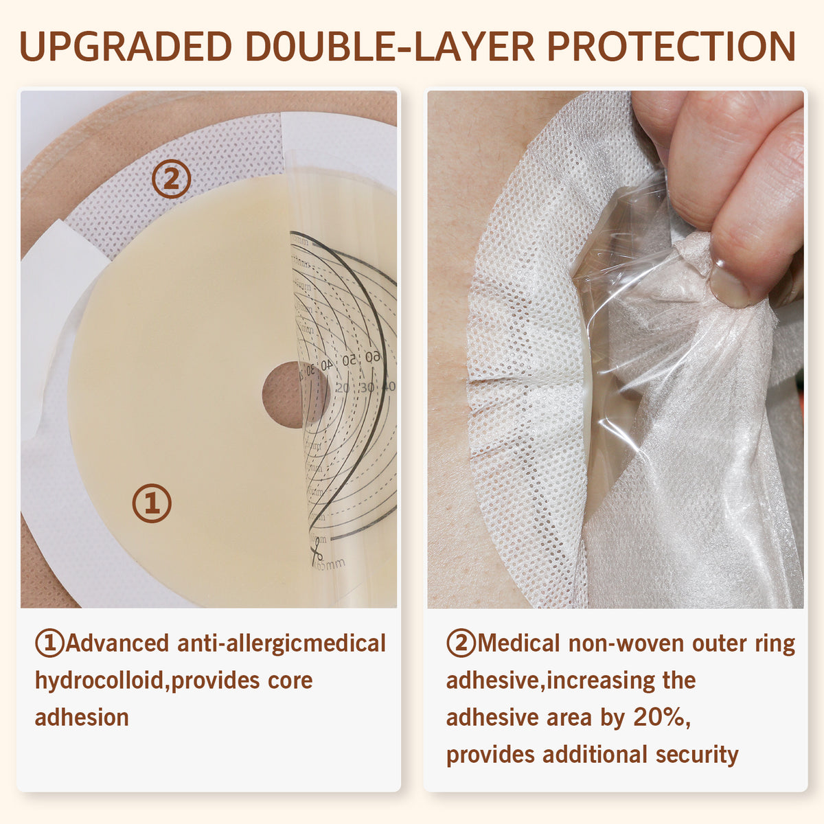 Colostomy Bags, One Piece Drainable Pouches for Stoma Care – KONWEDA MEDICAL Colostomy Bags, One Piece Drainable Pouches for Stoma Care – KONWEDA MEDICAL