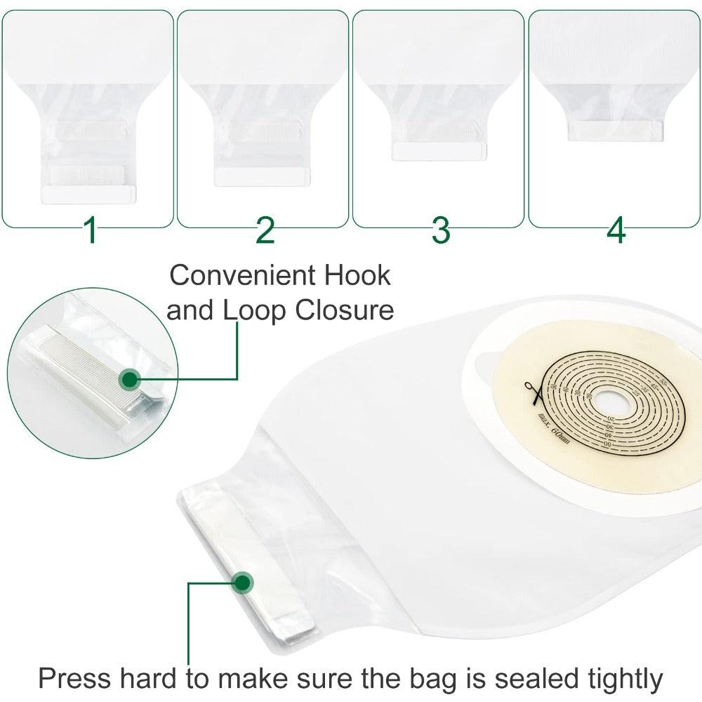 Sticking of the ConvaTec one-piece ostomy bag over the right-sided